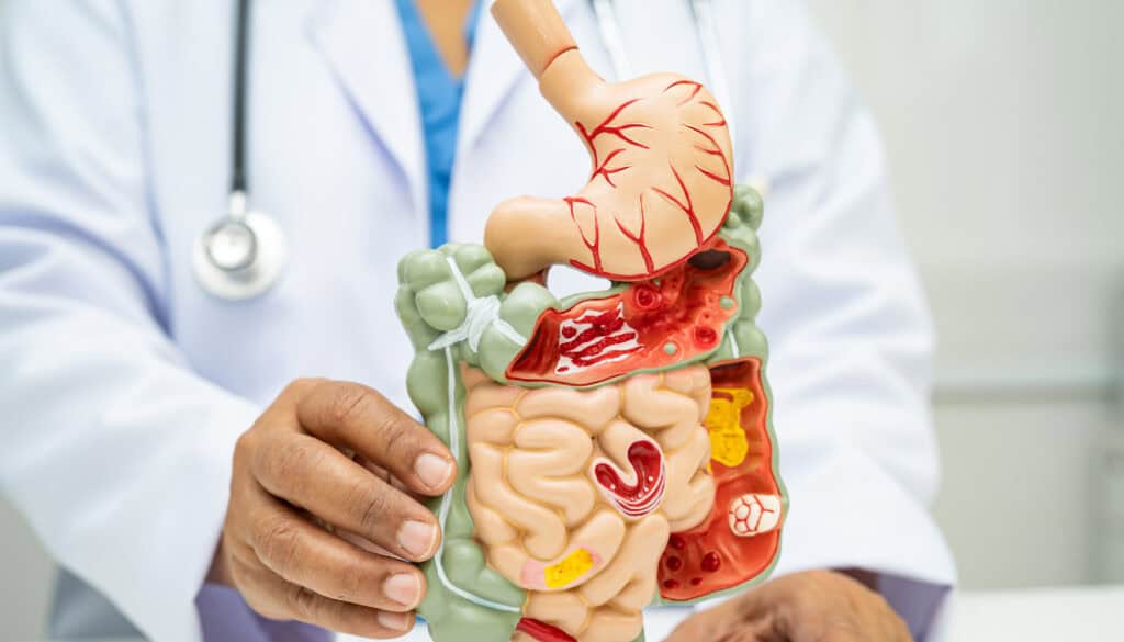 medecin montrant une maquette d'intestins